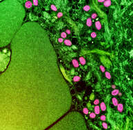 Image of Monkeypox virus