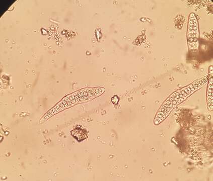 Image de Thelotrema lepadinum (Ach.) Ach.