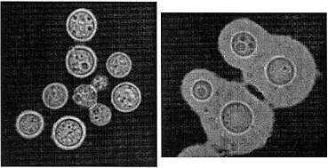 Image de Cryptococcus