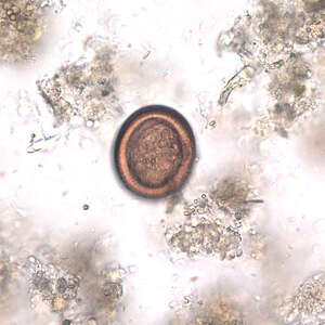 Image of Echinococcus