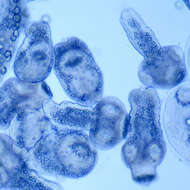 Image of Echinococcus granulosus