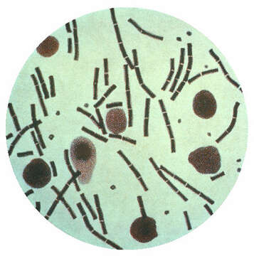 Imagem de Bacillus anthracis