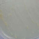 Image of Mycobacteroides abscessus