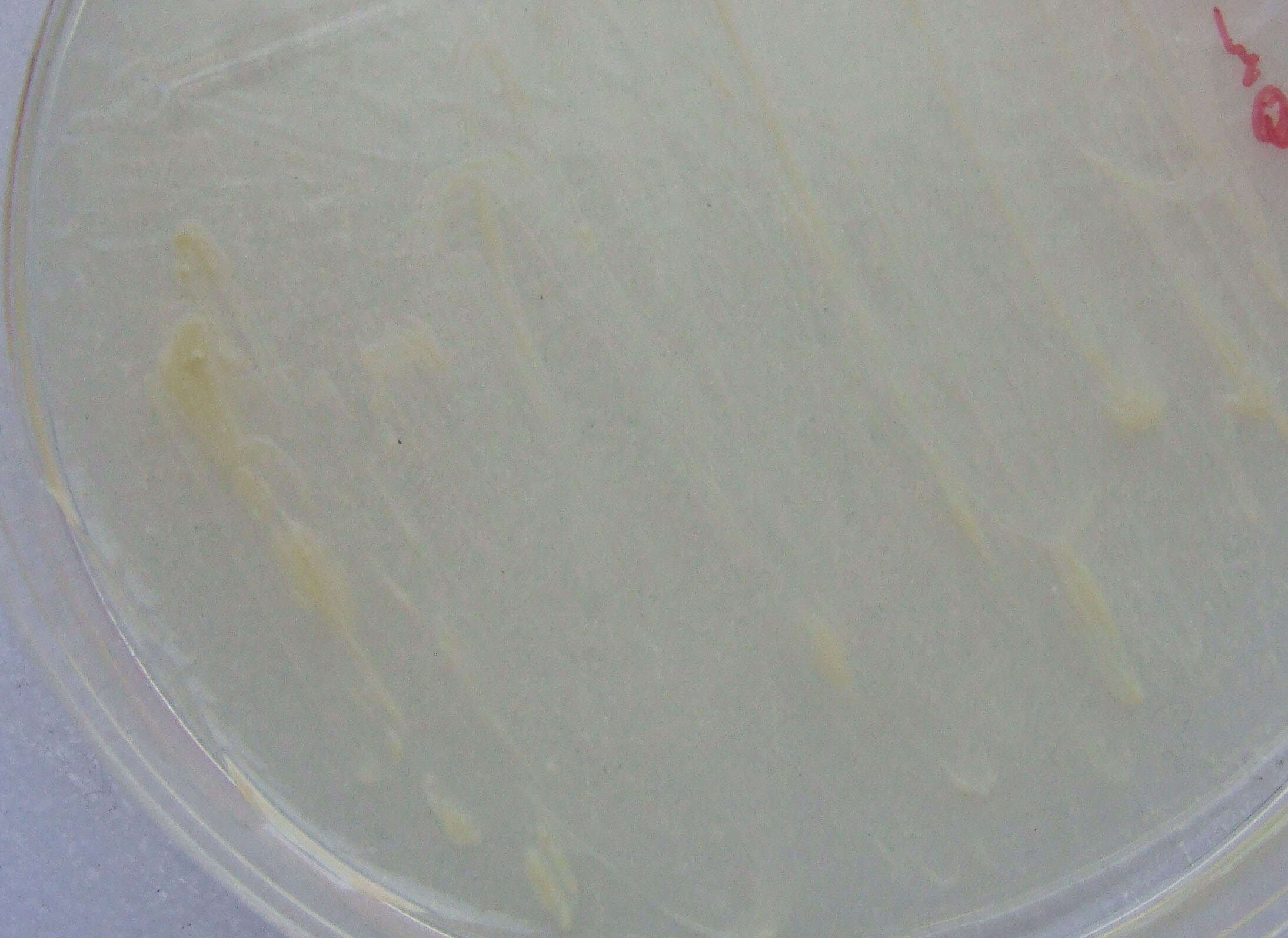Image of Mycobacteroides abscessus