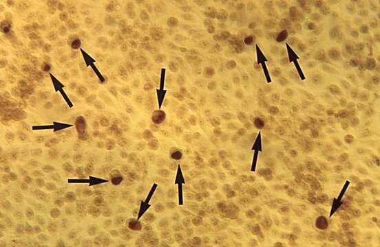 Image of Chlamydia trachomatis