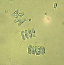 Image of Desmodesmus (R. Chodat) S. S. An, T. Friedl & E. Hegewald 1999
