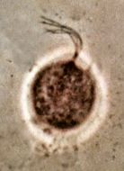 Image of <i>Trichomonas vaginalis</i>
