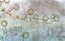 Image de Candida albicans (C. P. Robin) Berkhout 1923