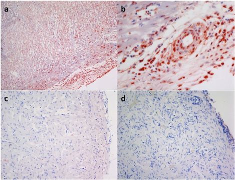 Image of influenza virus