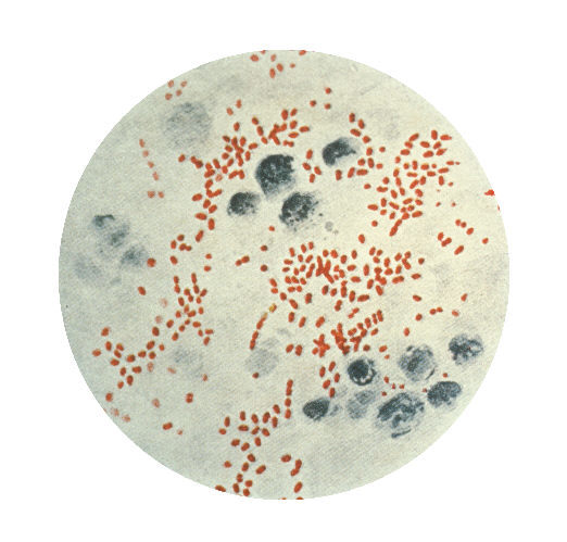 Image of <i>Yersinia pestis</i>