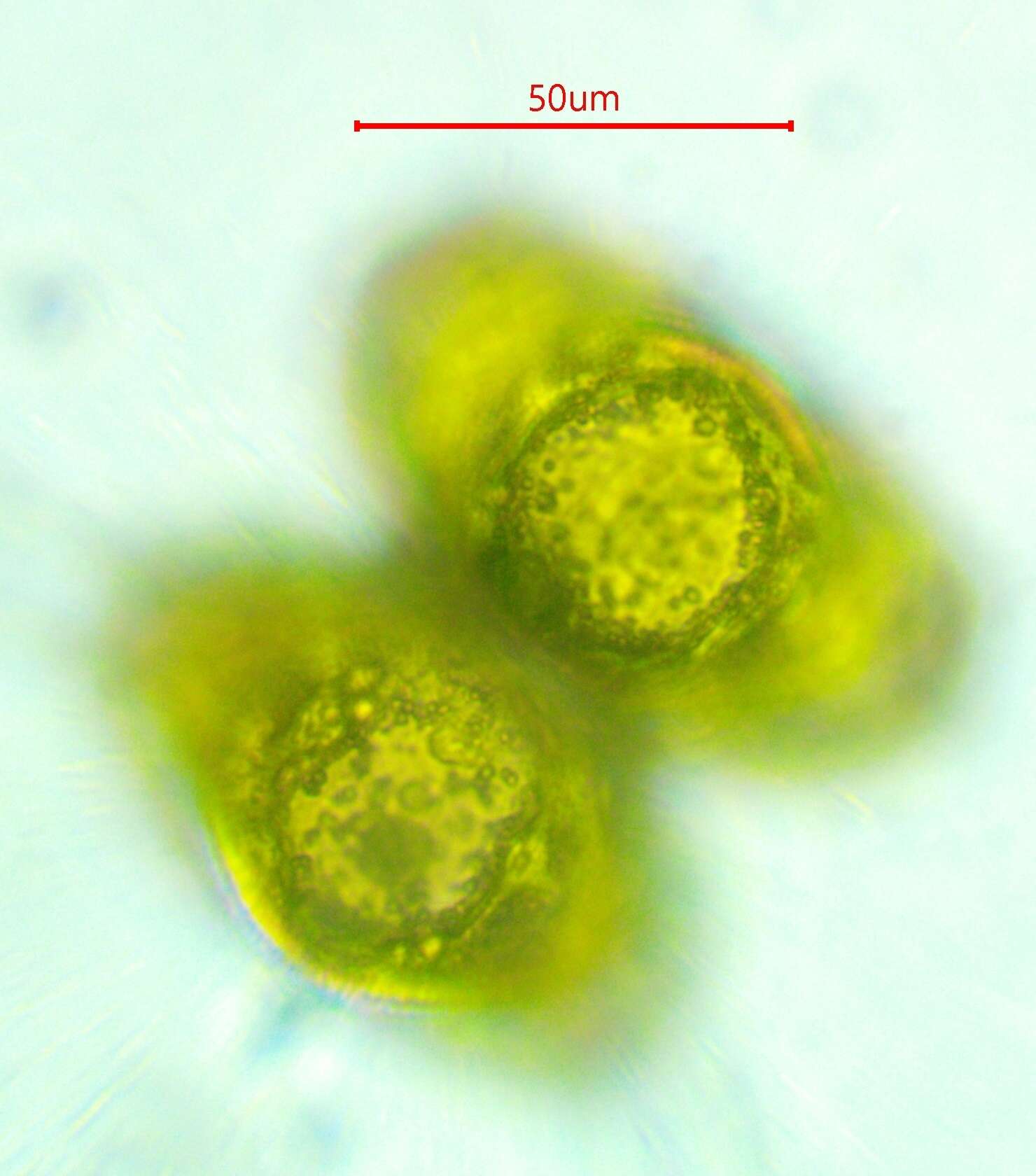 Image of Staurastrum longispinum (Bailey) W. Archer 1861