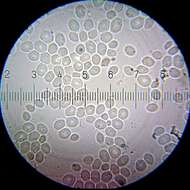 Imagem de Saccharomyces cerevisiae