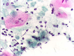 Image of <i>Trichomonas vaginalis</i>