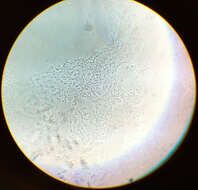 Image of Clostridium