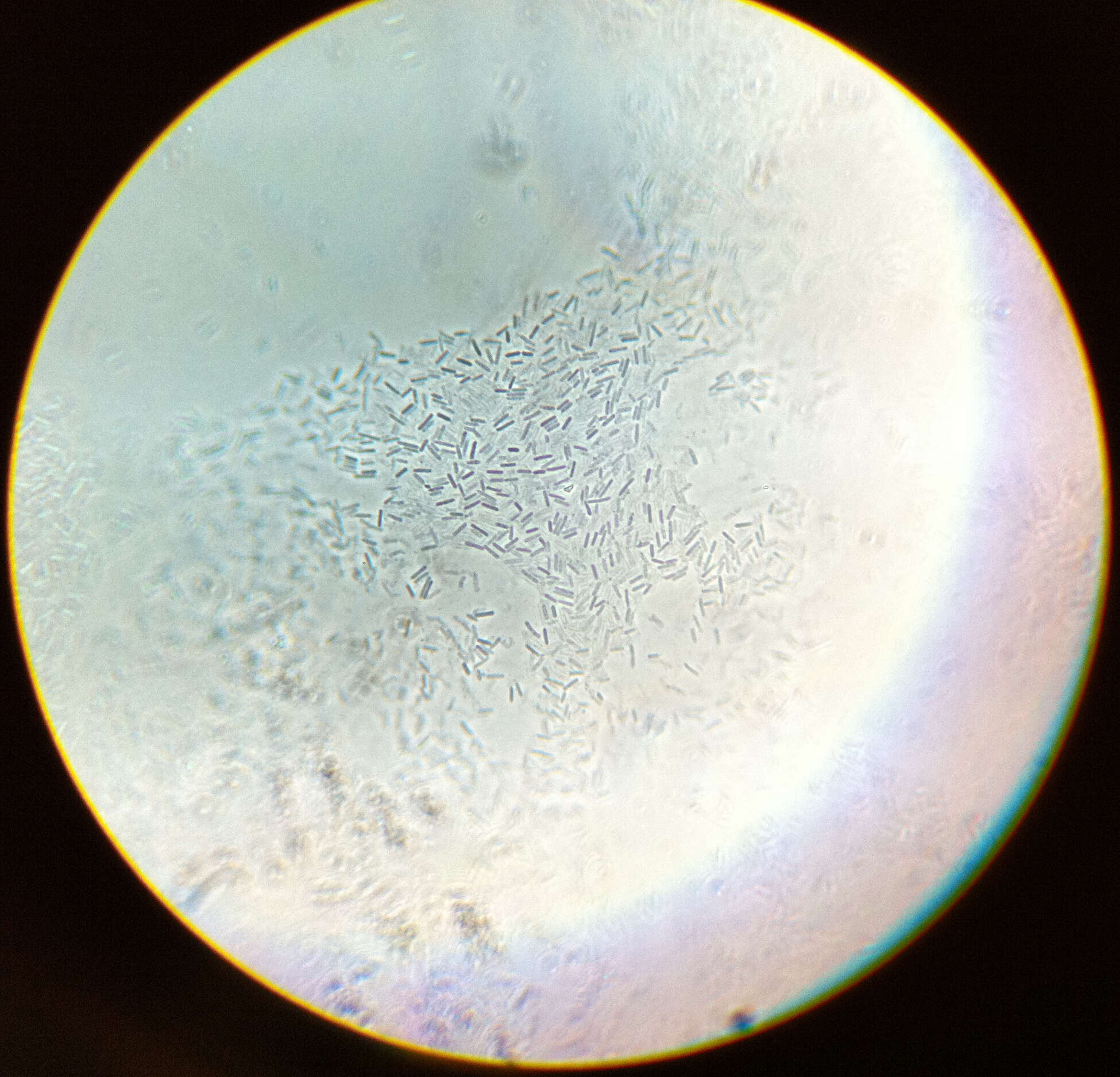 Image de Clostridium
