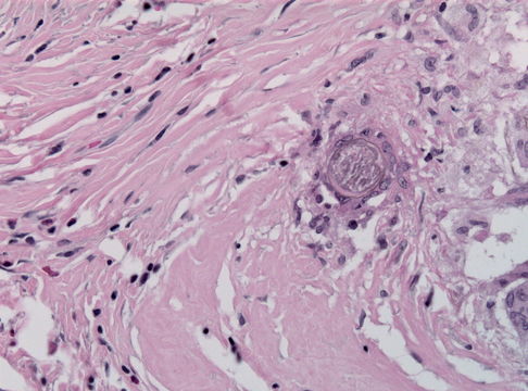 Image of <i>Schistosoma mansoni</i> Sambon 1907