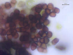 Image de Puccinia tumida Grev. 1824