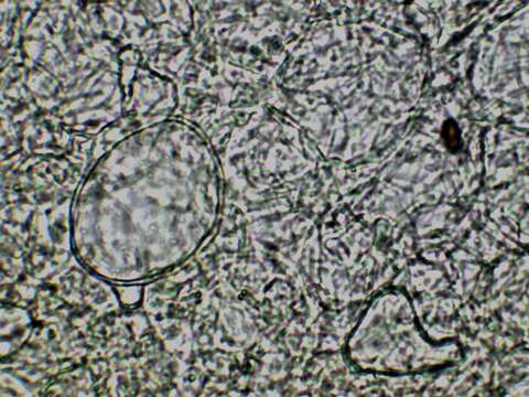 Plancia ëd Pachyella celtica (Boud.) Häffner 1993