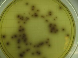 Image of <i>Listeria monocytogenes</i>