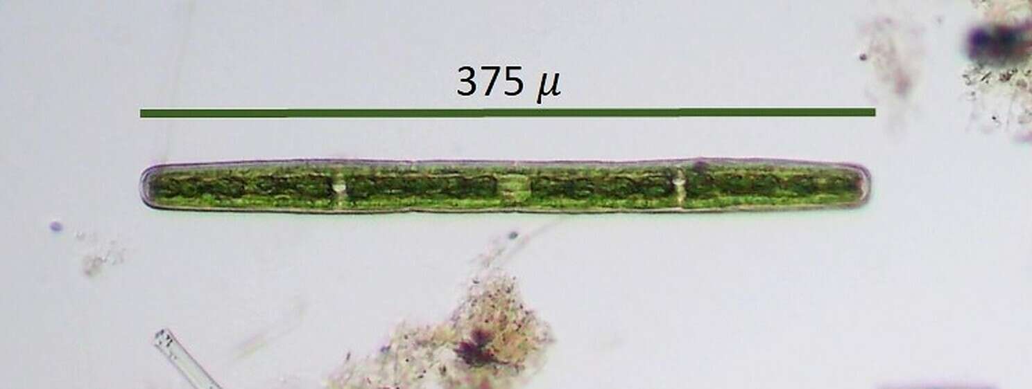 Image de Penium spirostriolatum