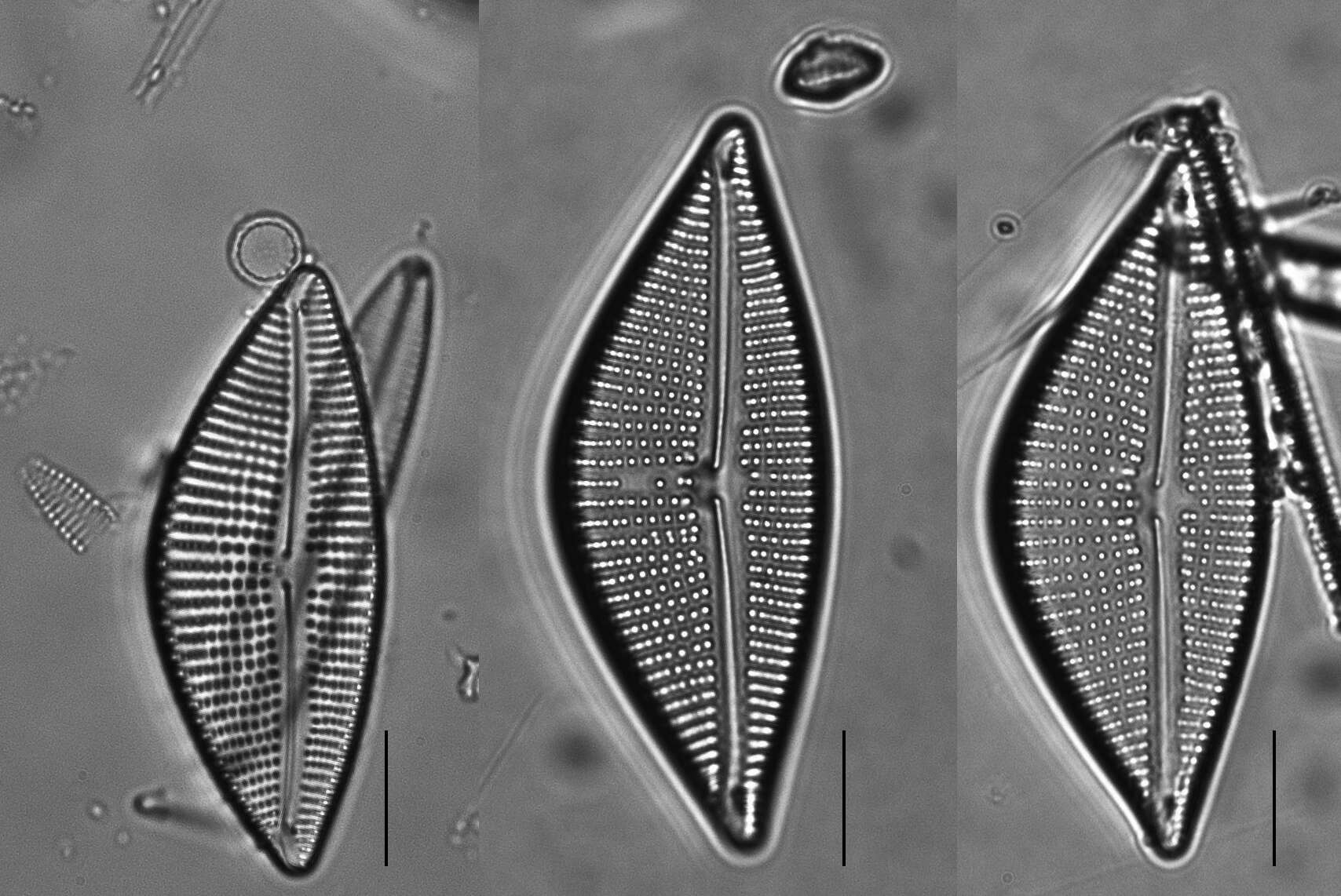 Image de Encyonema triangulum