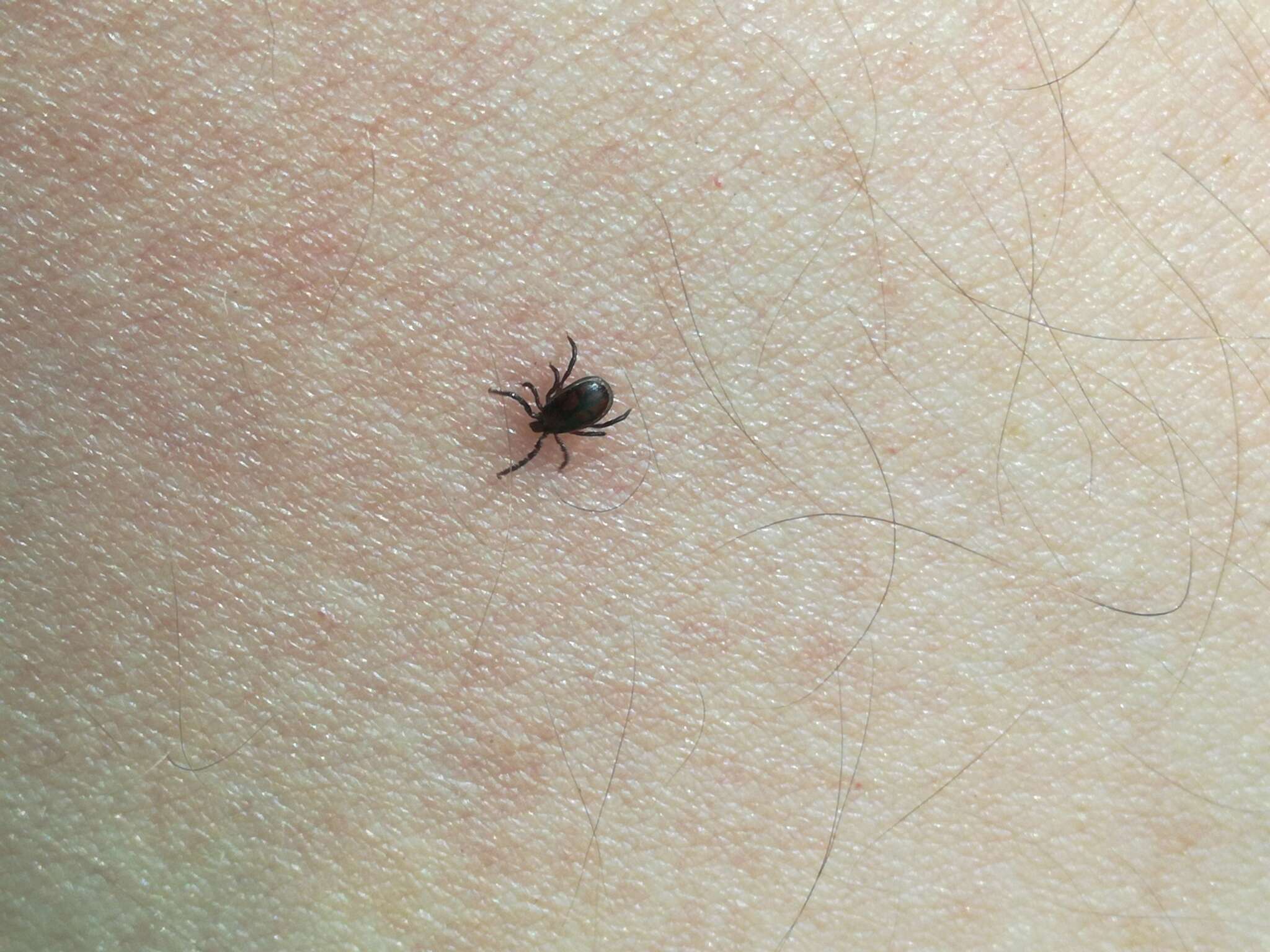 Image of Common sheep tick