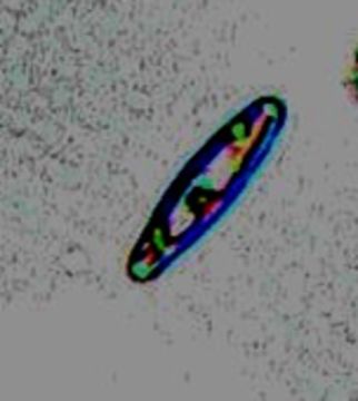 Image of Navicula