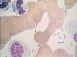Image of 'Yersinia pseudotuberculosis complex'