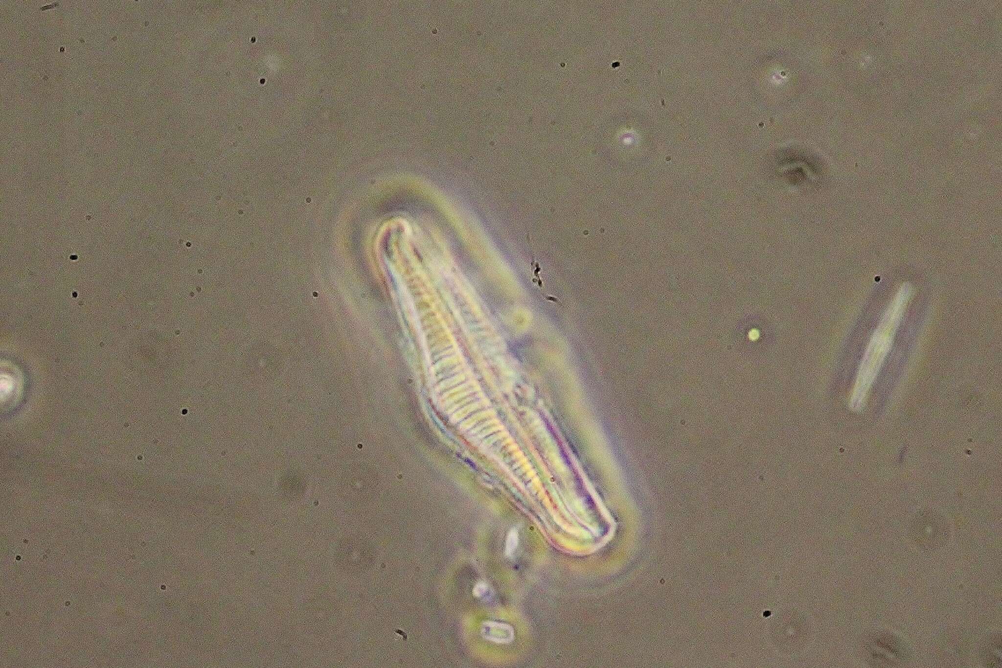 Image of <i>Epithemia gibba</i> Kützing