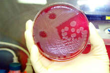 Image of Bacillus anthracis