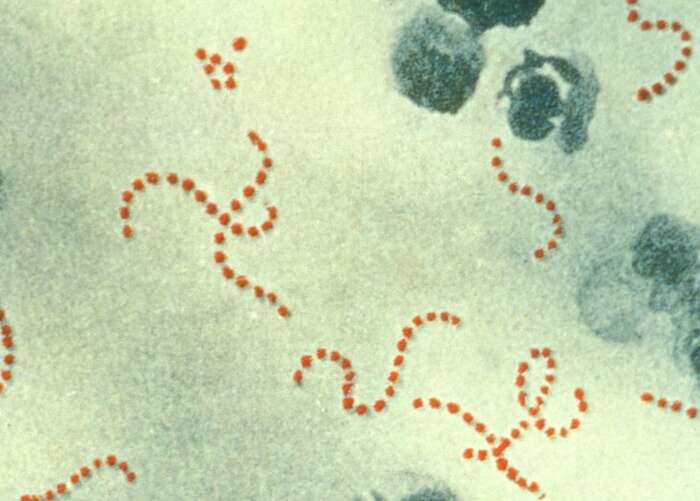 Image of Streptococcus pyogenes