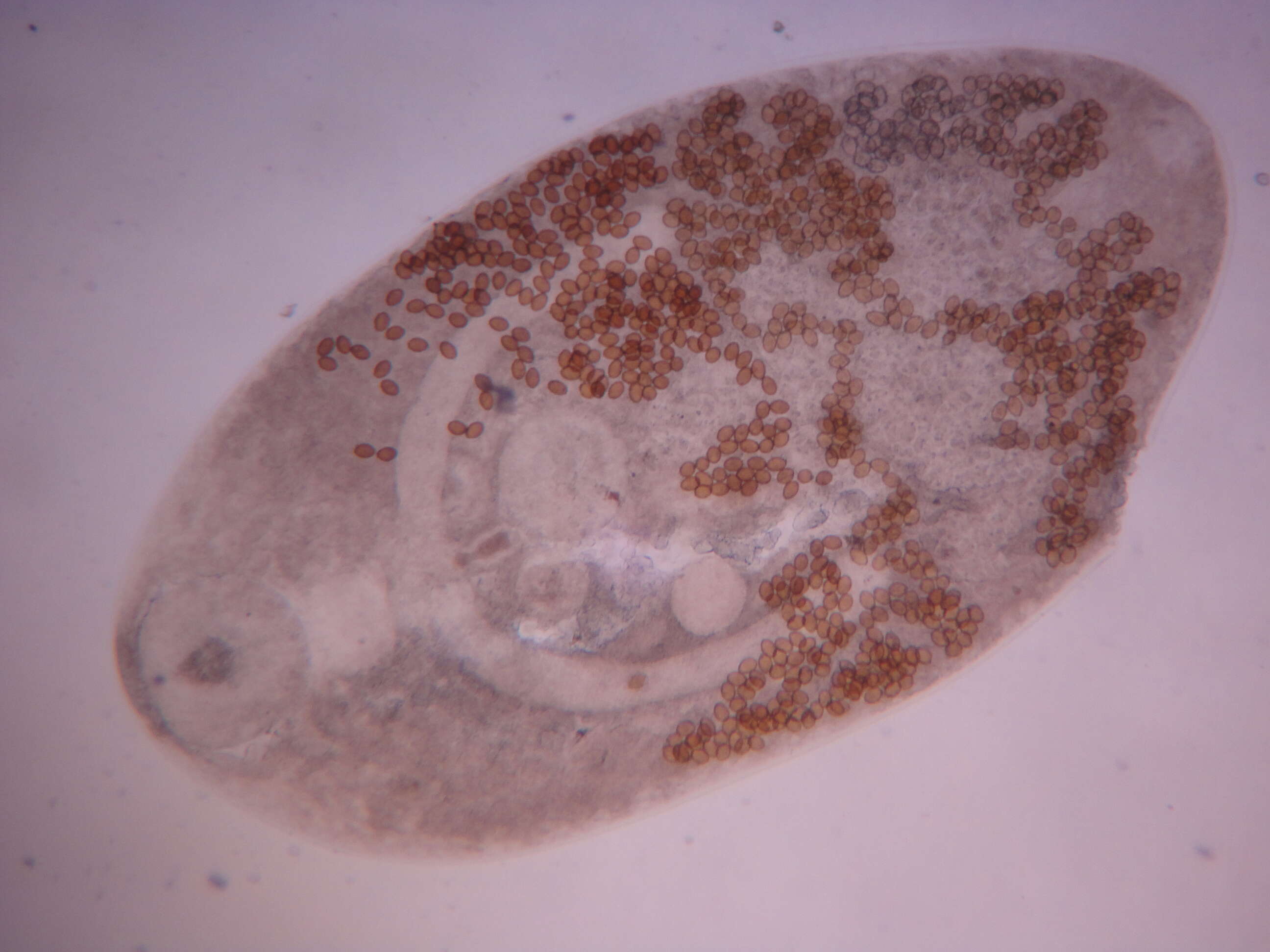Image of Parasitic Flatworms