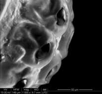 Image of head louse