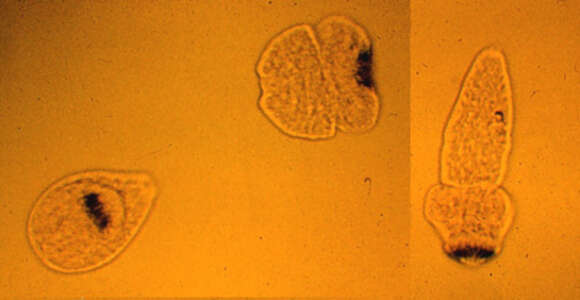 Image of Echinococcus multilocularis