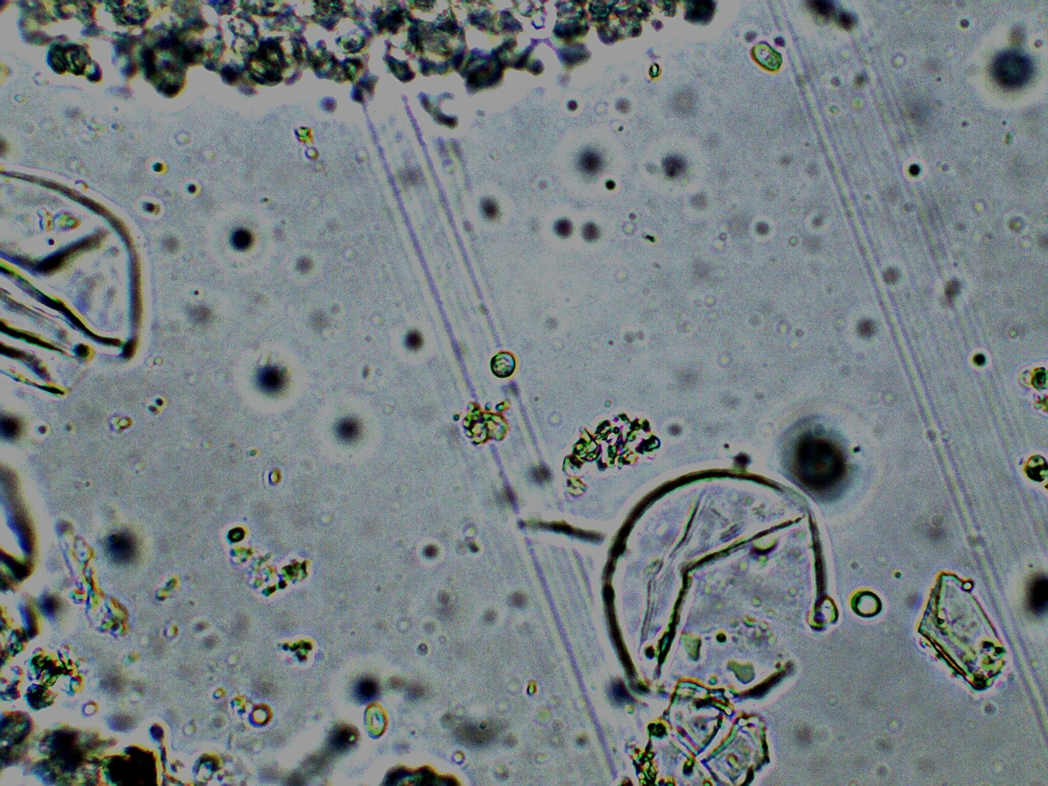 Image of Cystolepiota seminuda (Lasch) Bon 1976