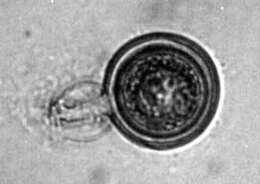 Image of Phytophthora de Bary 1876