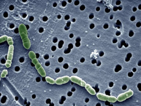 Image of <i>Oenococcus oeni</i>