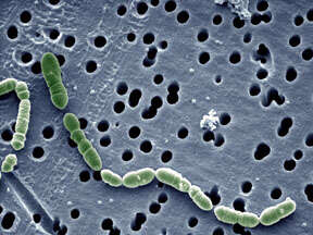 Image de Oenococcus oeni