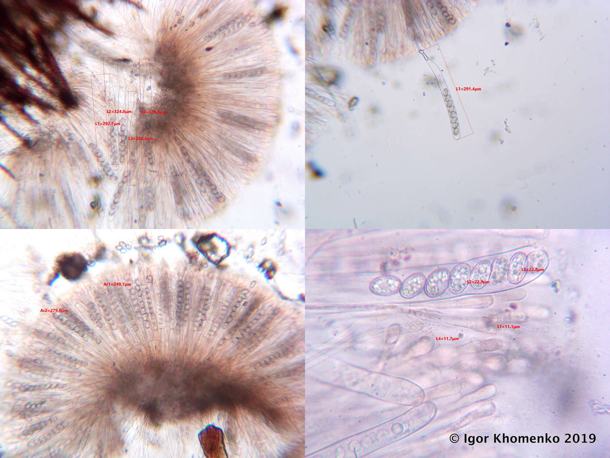 Image of Scutellinia nigrohirtula (Svrček) Le Gal 1964