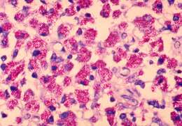 Image of Mycobacterium avium