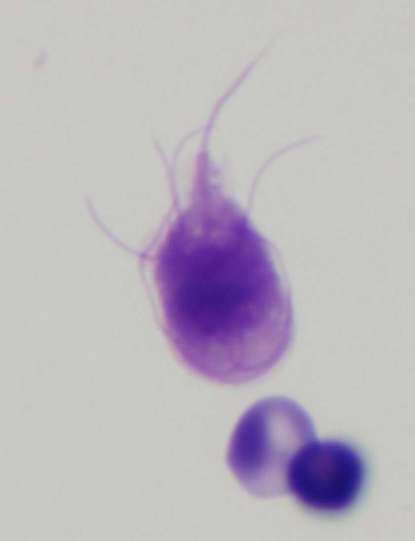 Image of Giardia intestinalis