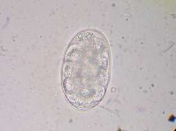 Image of Ancylostoma caninum