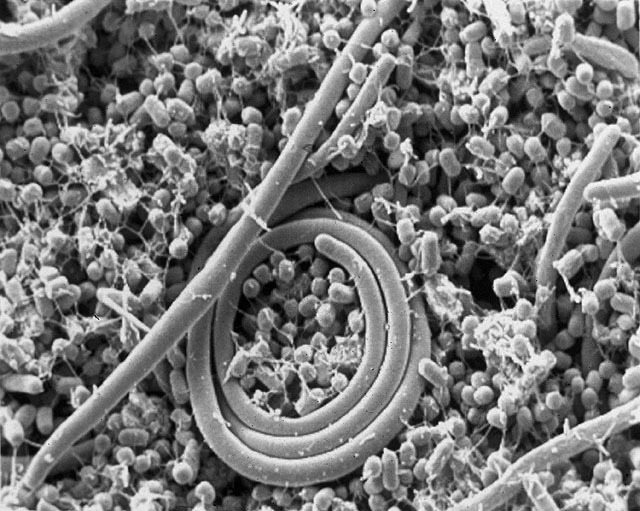 Image of <i>Salmonella enterica</i>