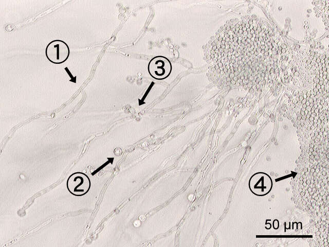 Image de Candida albicans (C. P. Robin) Berkhout 1923