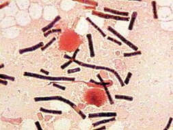 Image of Bacillus anthracis