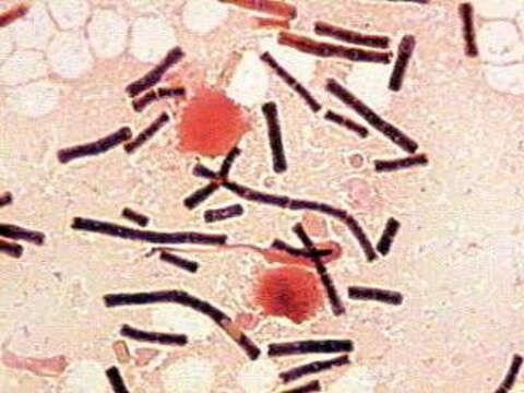 Imagem de Bacillus anthracis