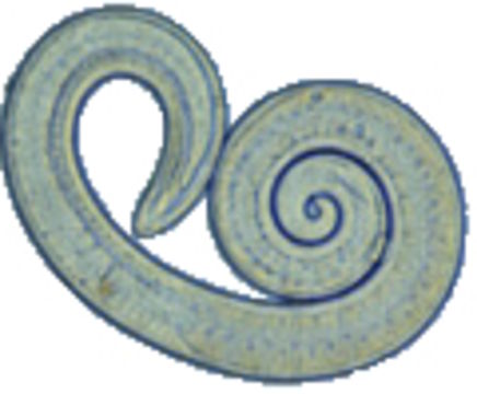 Image of <i>Trichinella spiralis</i> (Owen 1835)