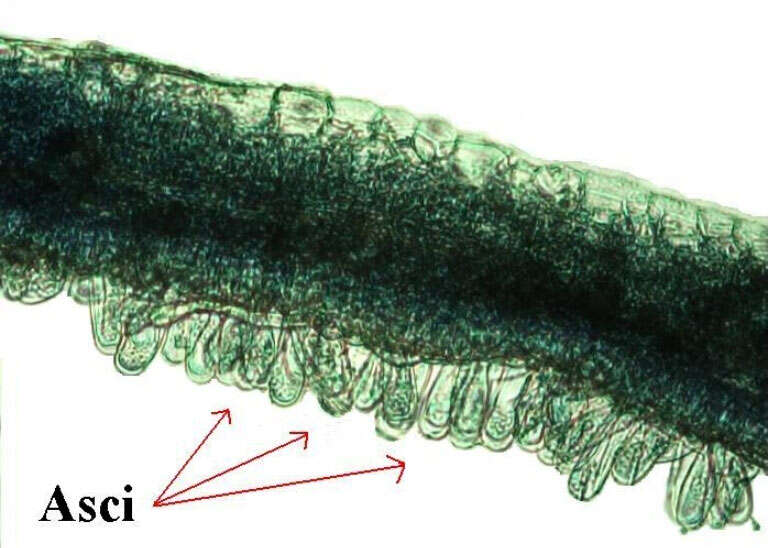 Image of Taphrina caerulescens (Desm. & Mont.) Tul. 1866