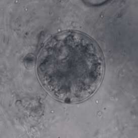 Image of chitridiomycetes