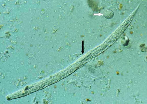 Image of Strongyloides